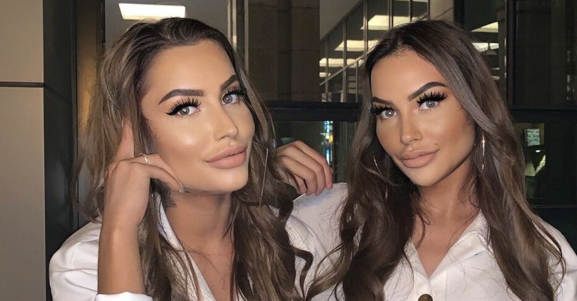 FOTO: zo zagen de Terror Twins er uit vóór alle cosmetische ingrepen