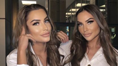 FOTO: zo zagen de Terror Twins er uit vóór alle cosmetische ingrepen