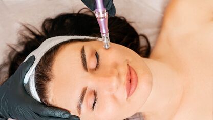 Wat is microneedling?